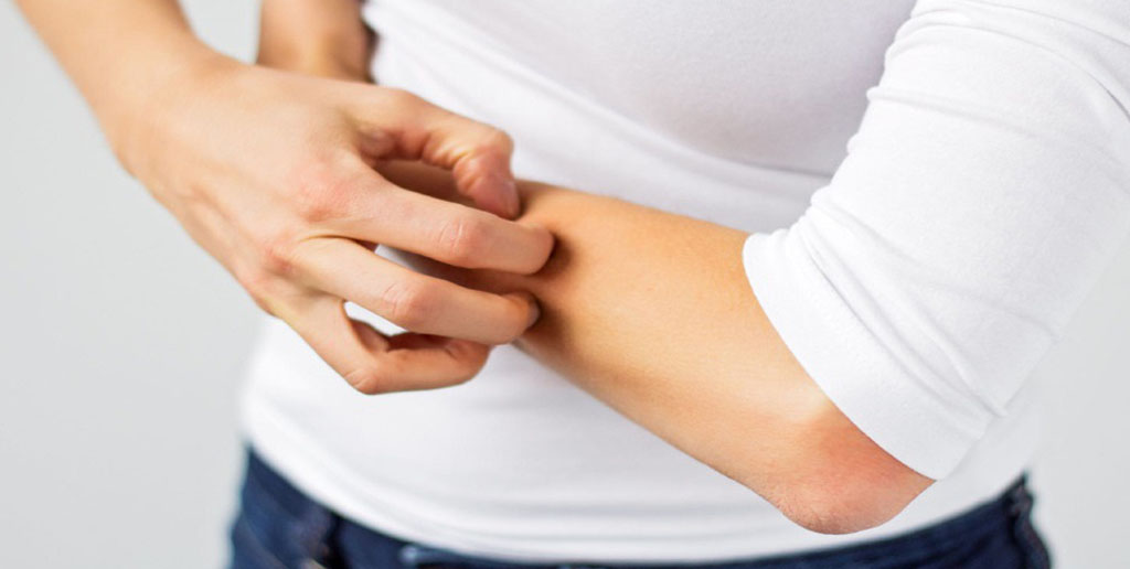 هفت خوراکی که اختلالات پوستی را از بین می‌برند