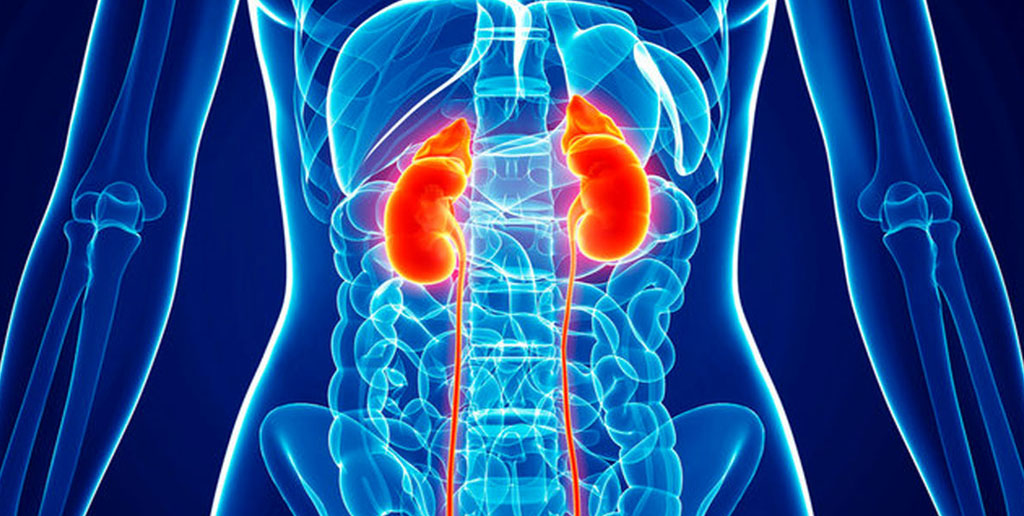 پاکسازی کلیه ها با مصرف چند خوراکی